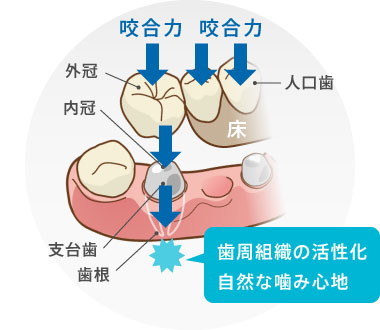 歯周組織の活性化自然な噛み心地